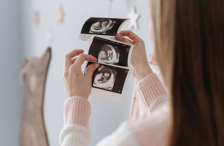 Periodo perinatal y neonatal desde un enfoque psicológico
