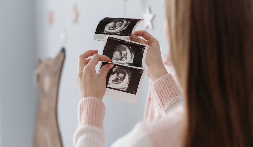 Periodo perinatal y neonatal desde un enfoque psicológico